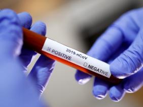 Senegal confirms first coronavirus case