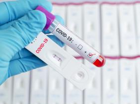 covid, blood test covid, blood test