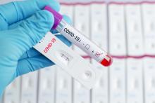 covid, blood test